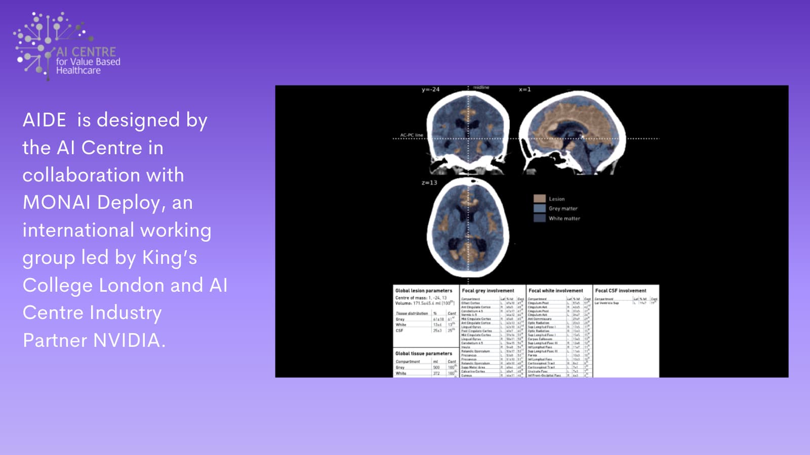 AIDE - User Interface with KCH Stroke Algorithm